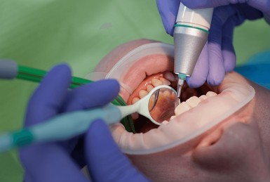 Professional dental cleaning and care