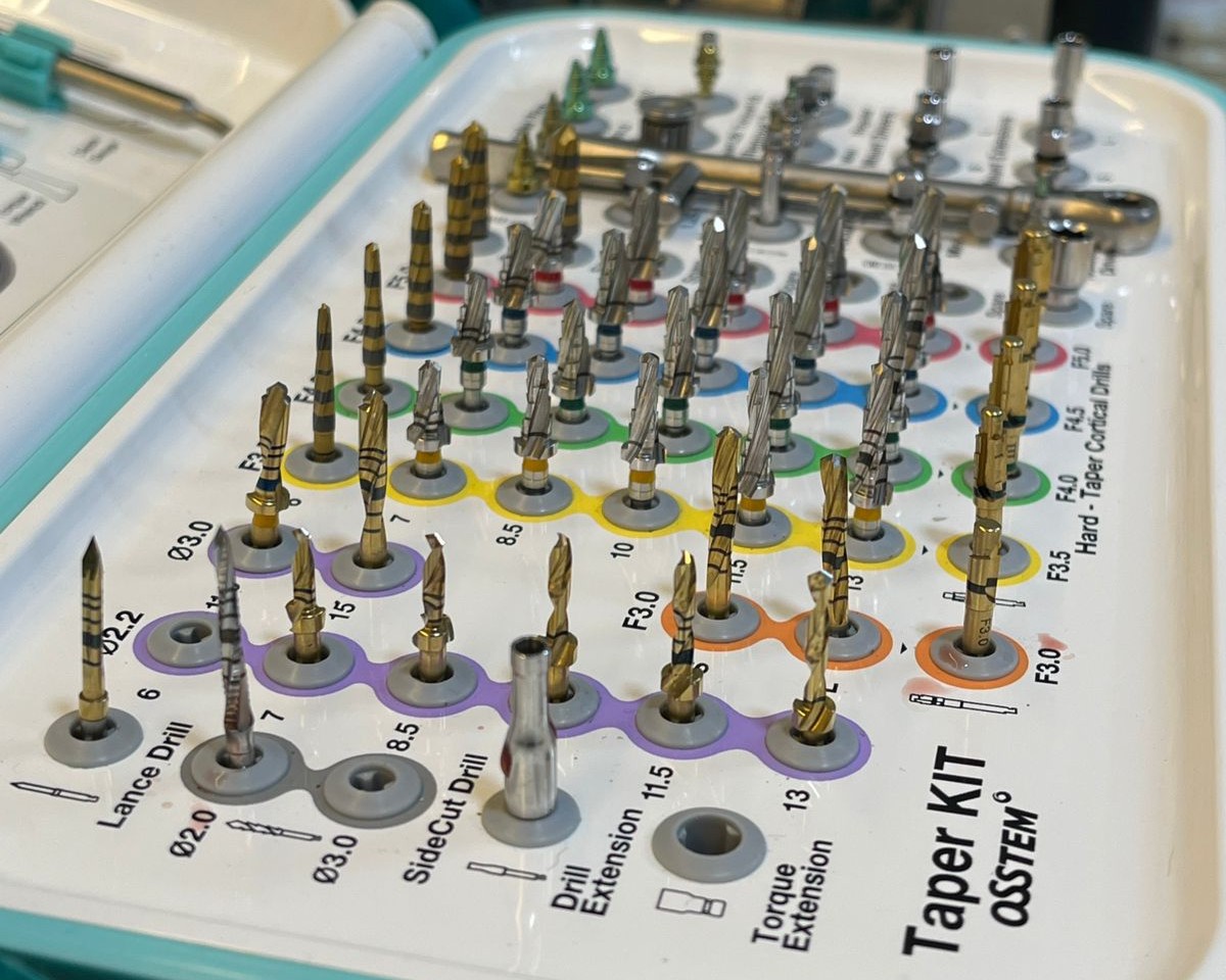 Dental implant treatment