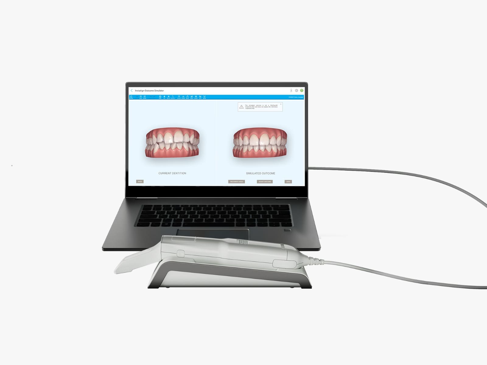 Invisalign treatment at Doon Dental Square